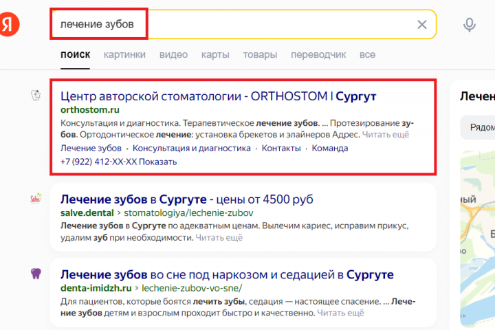 "Лечение зубов" — ТОП1 в г. Сургут для стоматологии «ОртоСтом»