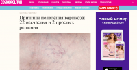 Причины появления варикоза