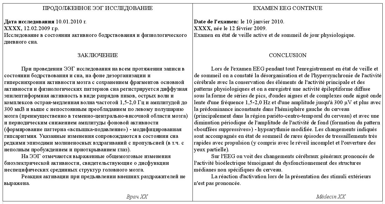 F-eeg-perevod.jpg